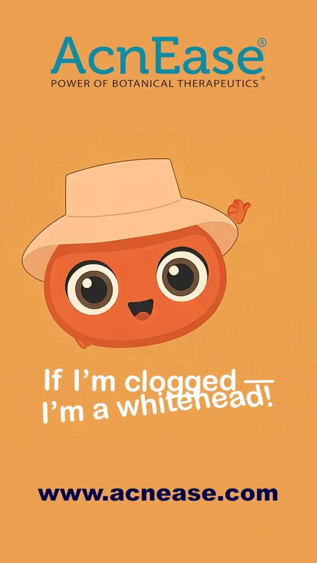 What are Whiteheads and Blackheads, and Can I Do Something About Them??